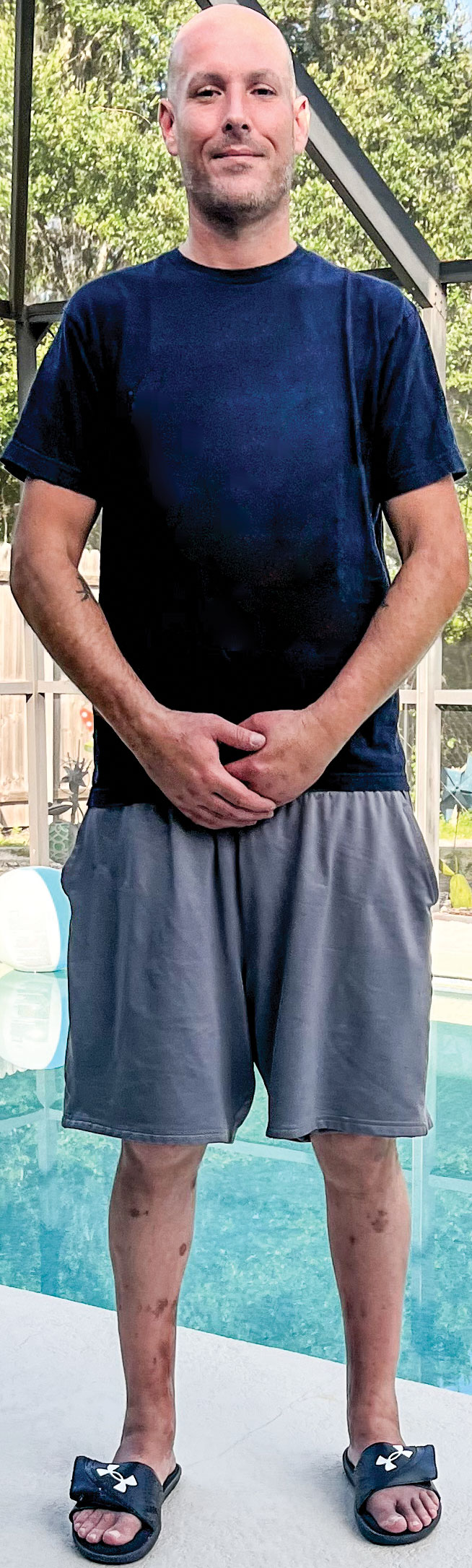 Clint McGeachy standing by pool in shorts