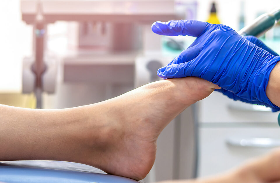 A Laser Solution for Toenail Fungus: Tami's Success Story