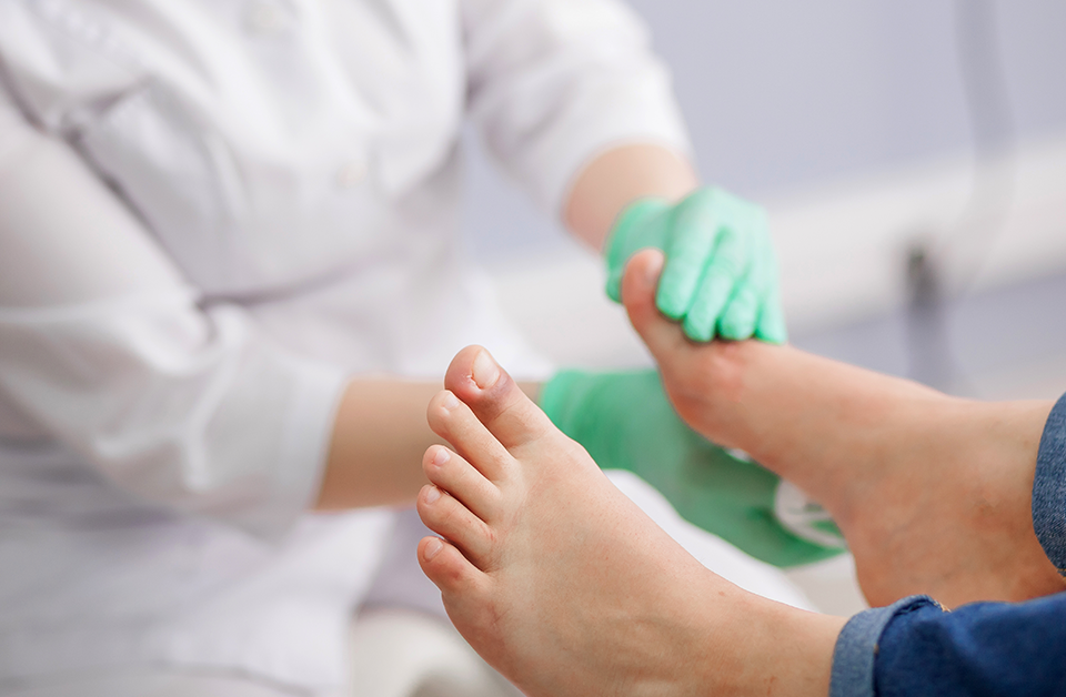 Toenail Fungus Gone With PinPointe Laser