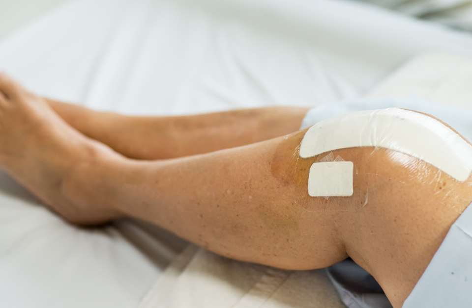 A Speedier Recovery From Joint Replacement