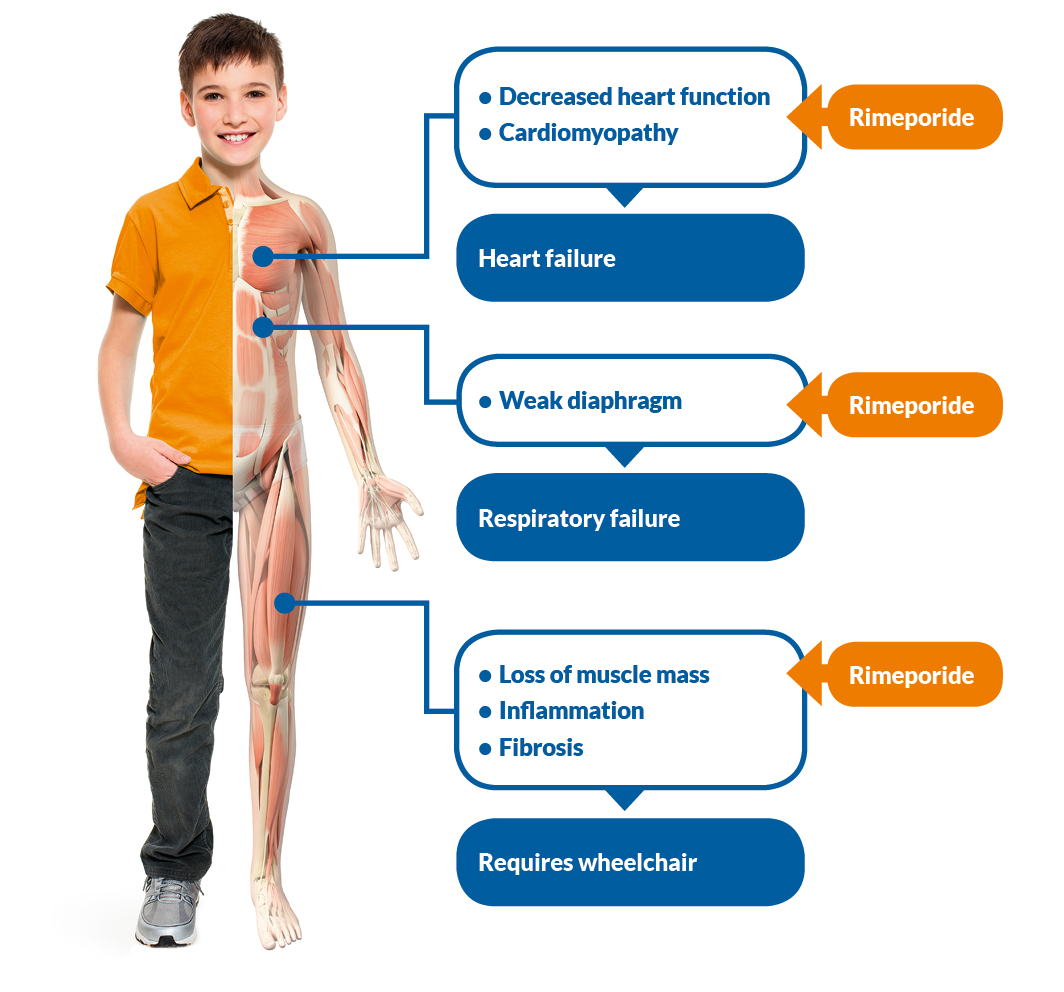 Defining DMD, The Most Common Form Of Muscular Dystrophy ...