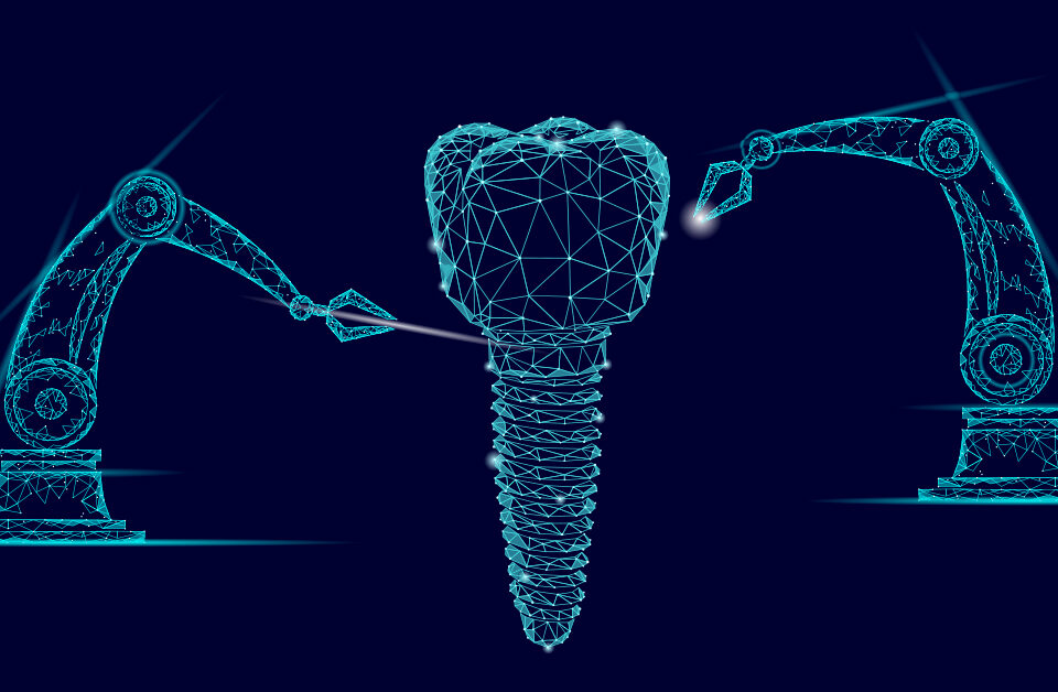 Precision Dental Implants: Robotics Revolutionize Tooth Replacement at Blossom Dental