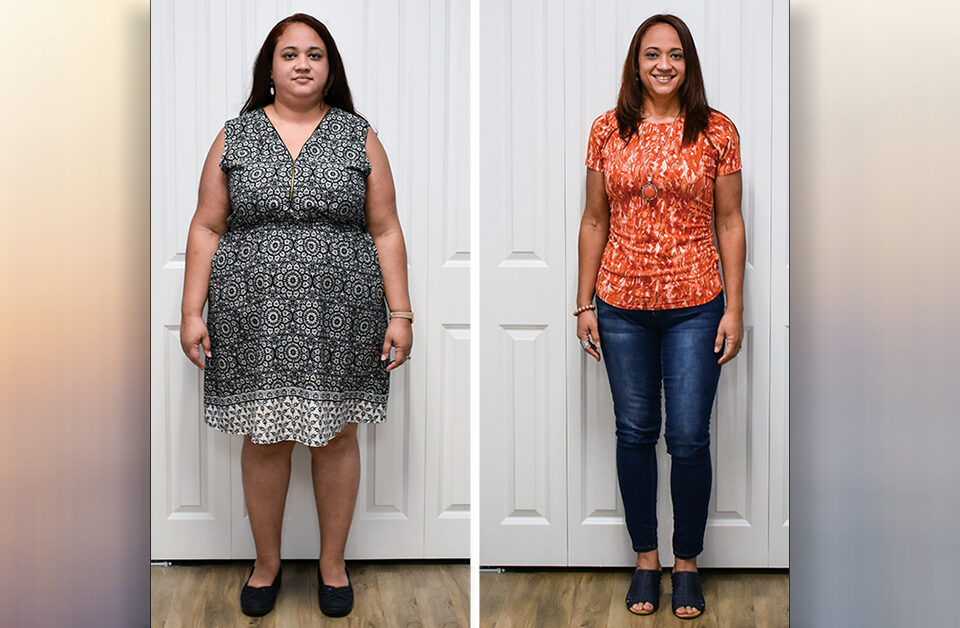 A Life-Changing Procedure: Jenny's Vertical Sleeve Gastrectomy