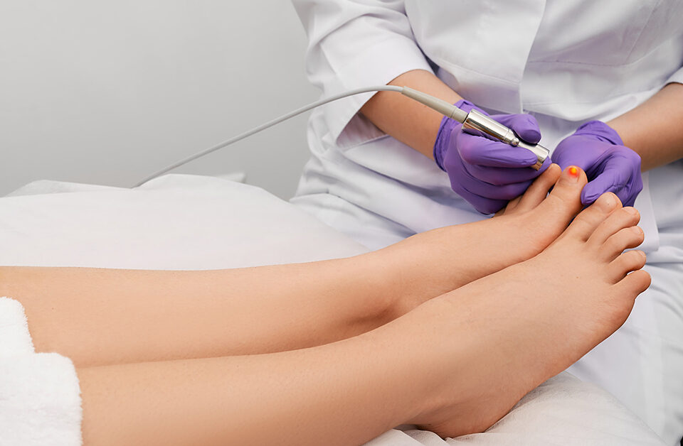 PinPointe FootLaser Therapy: A Painless Solution for Toenail Fungus