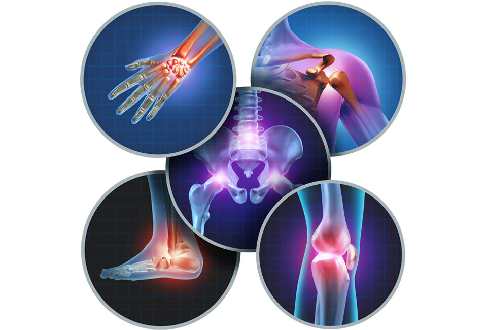 Comprehensive Pain Relief: QC Kinetix's Impact on Joint Health Beyond Knees